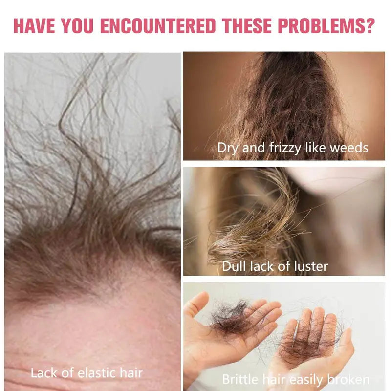 Myth of Silverlock Hair growth For Men And Women, Strengthens Hair And Beautiful Hair, Contains vitamin E and Lycium, Healthier Hair, Make Thin Hair Look Thicker, Healthy Hair Care