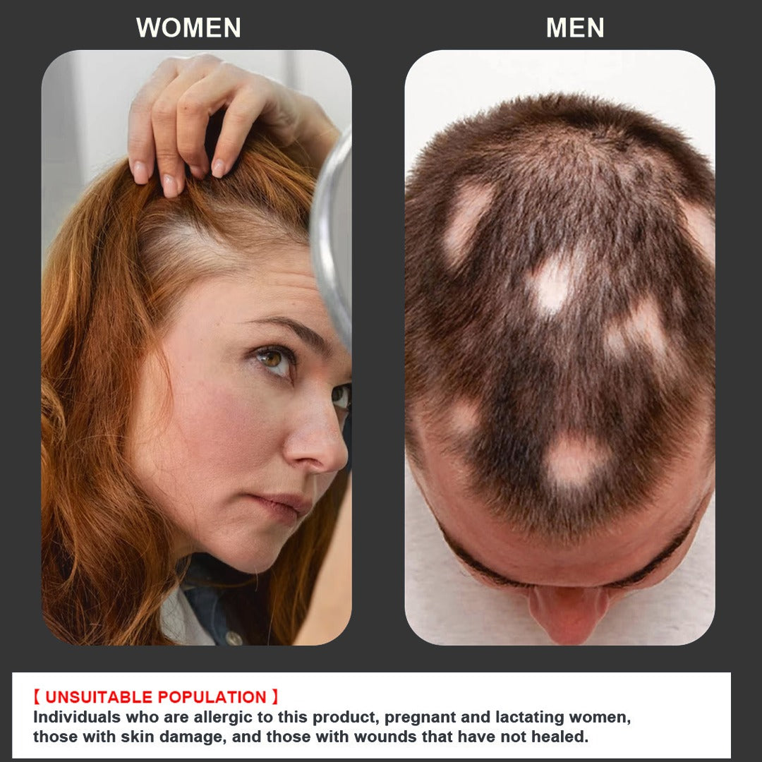 Myth of Silverlock Hair growth