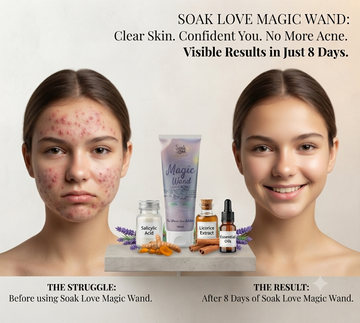 Magic Wand (anti acne cream)
