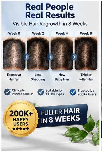 Myths of Silverlock hair regrowth and anti-hair fall serum by Soak In Love – image 18